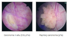 PDD i�in Ak�ll� ��z�mler<br></br>Beyaz ���k g�r�nt�s�