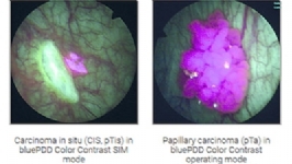bluePDD Renk Kontrast� SIM modu
