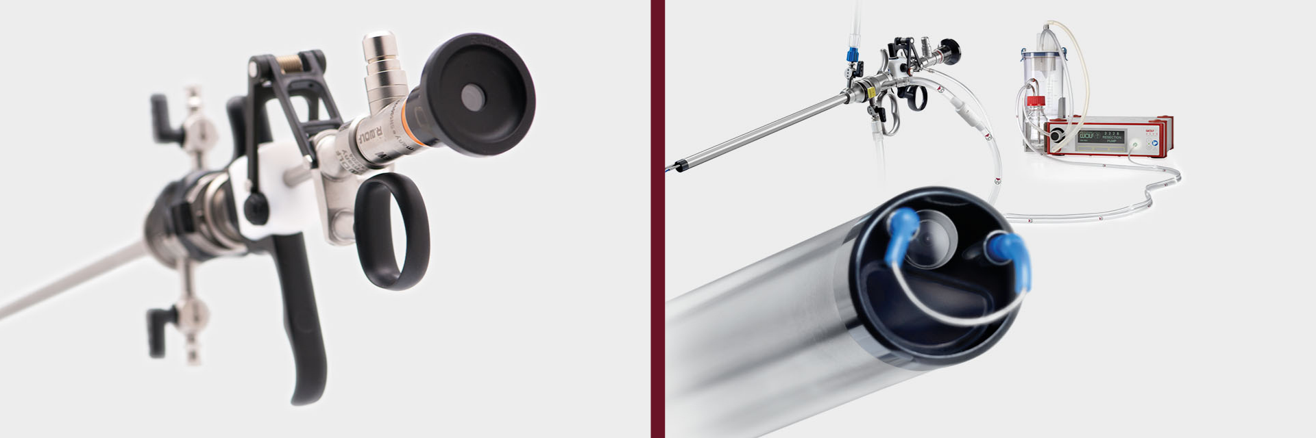 Diagnostik ve Operatif Histeroskopi