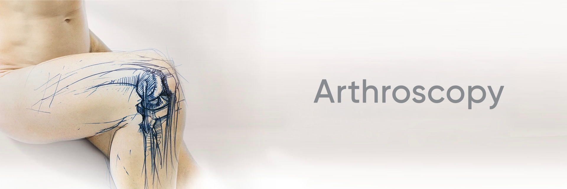 Arthroscopy