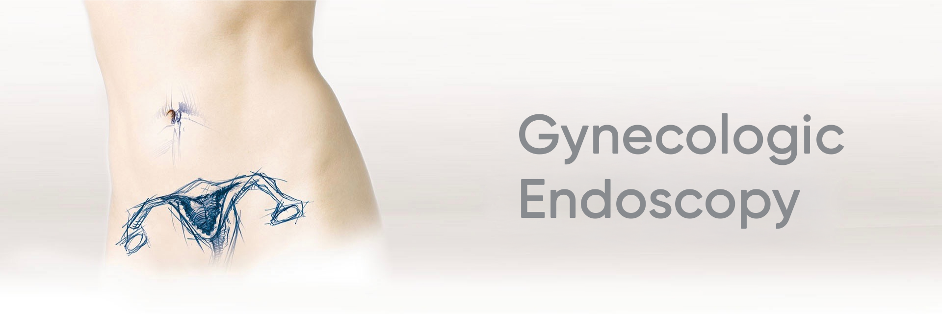 Gynecologic Endoscopy