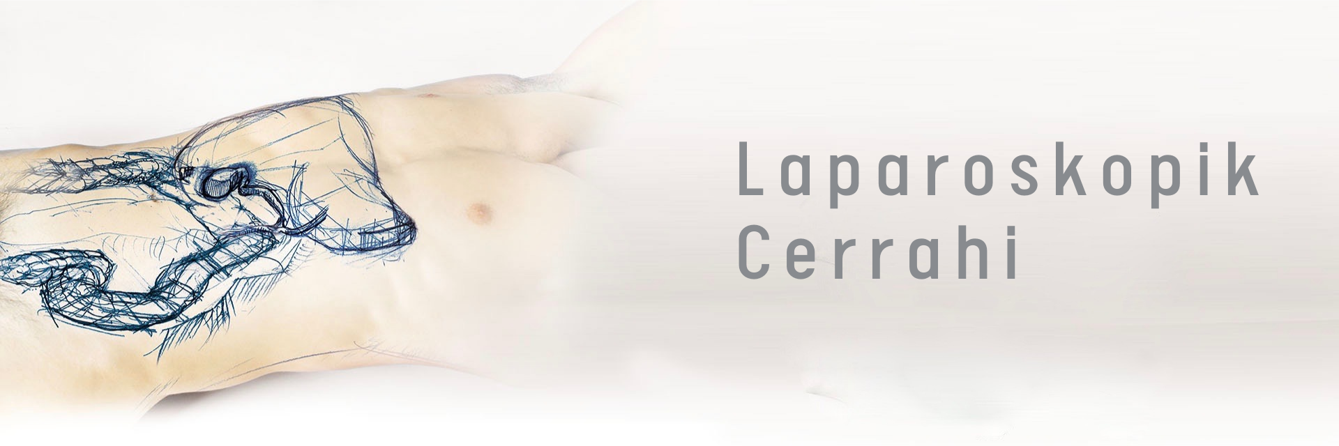 Laparoskopik Cerrahi