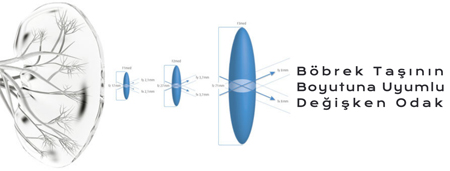 ��l� Odak - B�brek Ta��n�n Boyutuna Uyumlu De�i�ken Odak