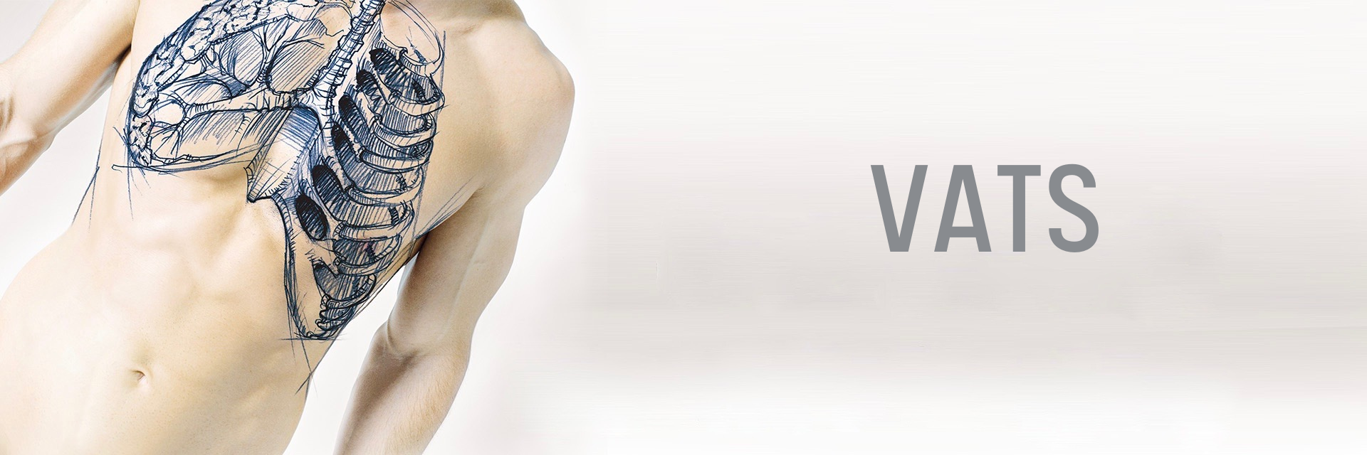 VATS